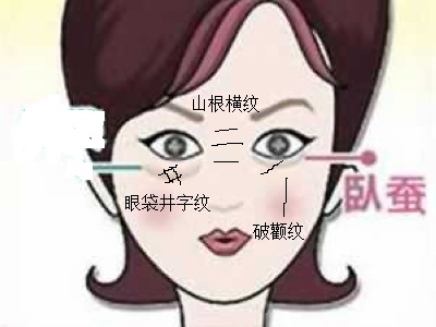 《相学精义》刘恒注解，鼻子纹痕面相篇（三）